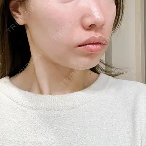 TCB東京中央美容外科 TCB東京中央美容外科 越谷院口コミ