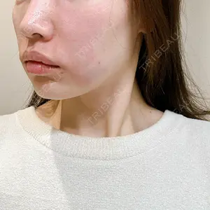 TCB東京中央美容外科 TCB東京中央美容外科 越谷院口コミ