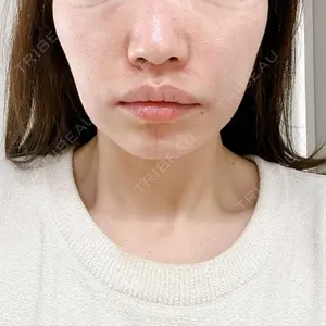 TCB東京中央美容外科 TCB東京中央美容外科 越谷院口コミ