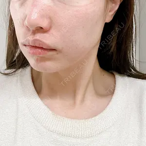 TCB東京中央美容外科 TCB東京中央美容外科 越谷院口コミ