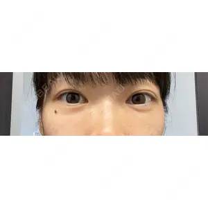東京BELLEZZAクリニック口コミ