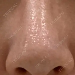 日本美容・医療クリニック 日本美容・医療クリニック 六本木院口コミ