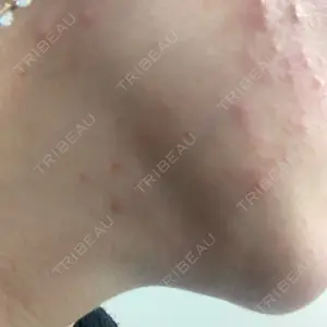 TCB東京中央美容外科 TCB東京中央美容外科 銀座有楽町院口コミ