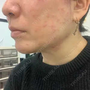 TCB東京中央美容外科 TCB東京中央美容外科 銀座有楽町院口コミ