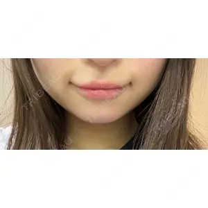 口コミ