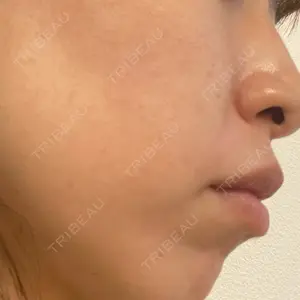 エースクリニック エースクリニック 大阪梅田HEPナビオ院口コミ