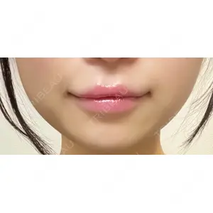 口コミ