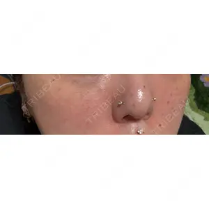 Natural Skin Clinic Natural Skin Clinic 自由ヶ丘院口コミ