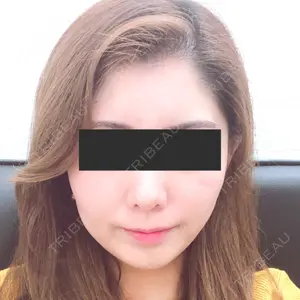 TCB東京中央美容外科 TCB東京中央美容外科 中野院口コミ