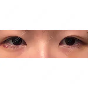 AI Beauty Clinic （エーアイ美容クリニック）口コミ