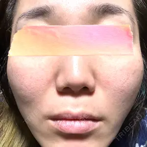 BAO CLINIC BAO CLINIC 心斎橋院口コミ