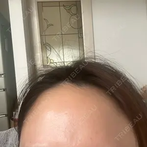 TCB東京中央美容外科 TCB東京中央美容外科 千葉駅前院口コミ