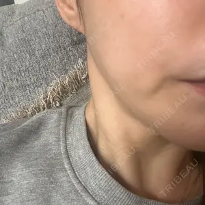 TCB東京中央美容外科 TCB東京中央美容外科 千葉駅前院口コミ