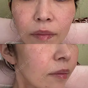 おおかみ美容のクリニック おおかみ美容のクリニック 新宿院口コミ