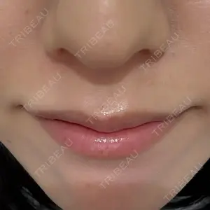 キアクリニック KIA CLINIC 心斎橋院口コミ