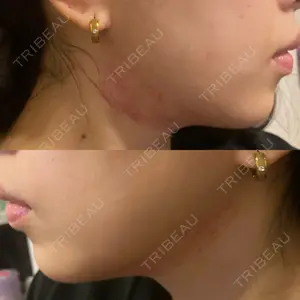 東京シルククリニック 東京シルククリニック 新宿院口コミ