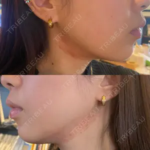 東京シルククリニック 東京シルククリニック 新宿院口コミ