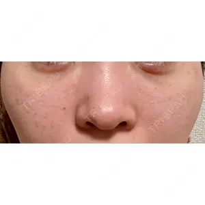 BISIN GINZA CLINIC口コミ