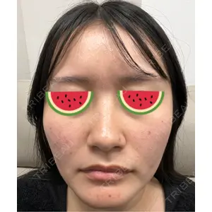 BISIN GINZA CLINIC口コミ