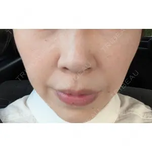 ルラ美容クリニック ルラ美容クリニック 岡山院口コミ