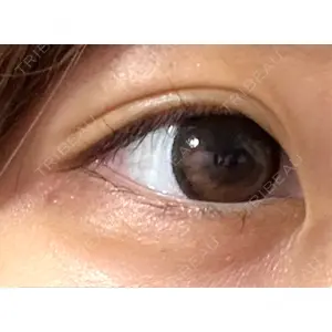 フィラークリニック フィラークリニック 新宿院口コミ