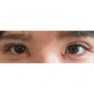 アイビークリニック 吉祥寺アイビークリニック口コミ