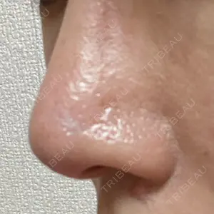 日本美容・医療クリニック 日本美容・医療クリニック 六本木院口コミ