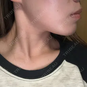 TCB東京中央美容外科 TCB東京中央美容外科 名古屋栄院口コミ