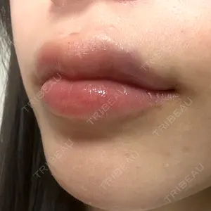 HAAB BEAUTY CLINIC 南青山本院（新院）口コミ