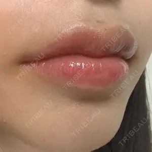 HAAB BEAUTY CLINIC 南青山本院（新院）口コミ