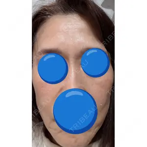 BISIN GINZA CLINIC口コミ