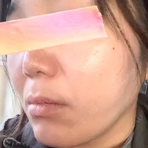 BAO CLINIC BAO CLINIC 心斎橋院口コミ