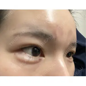 TCB東京中央美容外科 TCB東京中央美容外科 渋谷西口院口コミ