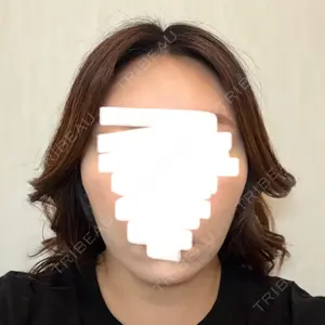 湘南美容クリニック 湘南美容クリニック 松戸院口コミ