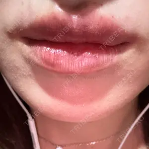 HAAB BEAUTY CLINIC 南青山本院（新院）口コミ