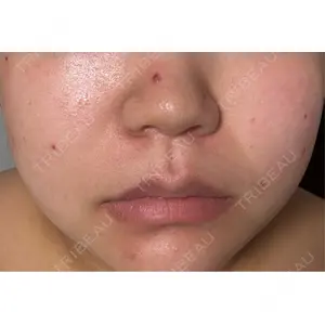 ルラ美容クリニック ルラ美容クリニック 仙台院 / ルラスキンクリニック 仙台院口コミ