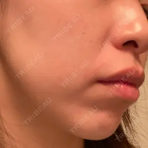 エースクリニック エースクリニック 大阪梅田HEPナビオ院口コミ