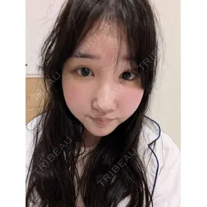 CZEN CLINIC 銀座院口コミ