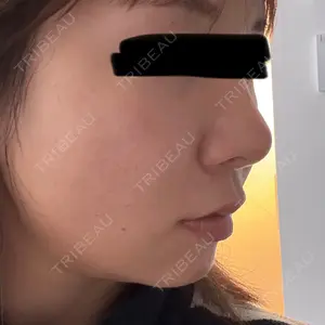 Nebula Clinic ネビュラクリニック 東京錦糸町院口コミ