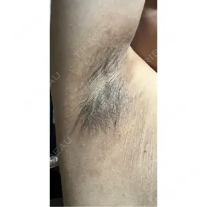 DMTC CLINIC DMTC美容皮膚科 大宮院口コミ