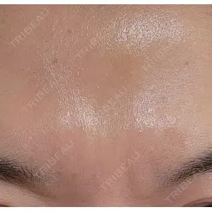 DMTC CLINIC DMTC美容皮膚科 大宮院口コミ