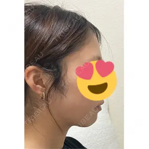 東京脂肪吸引クリニック口コミ