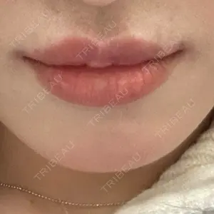 HAAB BEAUTY CLINIC 南青山本院（新院）口コミ