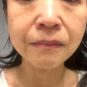 ルラ美容クリニック ルラ美容クリニック 名古屋本院口コミ