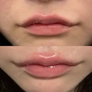 HAAB BEAUTY CLINIC 南青山本院（新院）口コミ