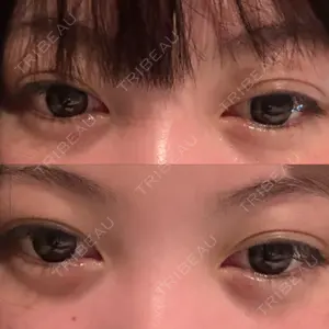 HAAB BEAUTY CLINIC 南青山本院（新院）口コミ