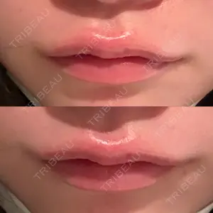 HAAB BEAUTY CLINIC 南青山本院（新院）口コミ