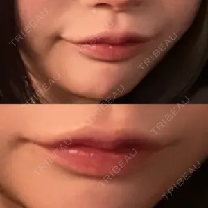 HAAB BEAUTY CLINIC 南青山本院（新院）口コミ