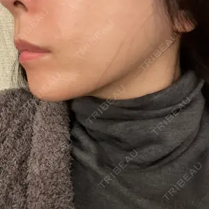 湘南美容クリニック 湘南美容クリニック 名古屋栄院口コミ