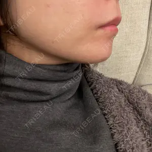 湘南美容クリニック 湘南美容クリニック 名古屋栄院口コミ